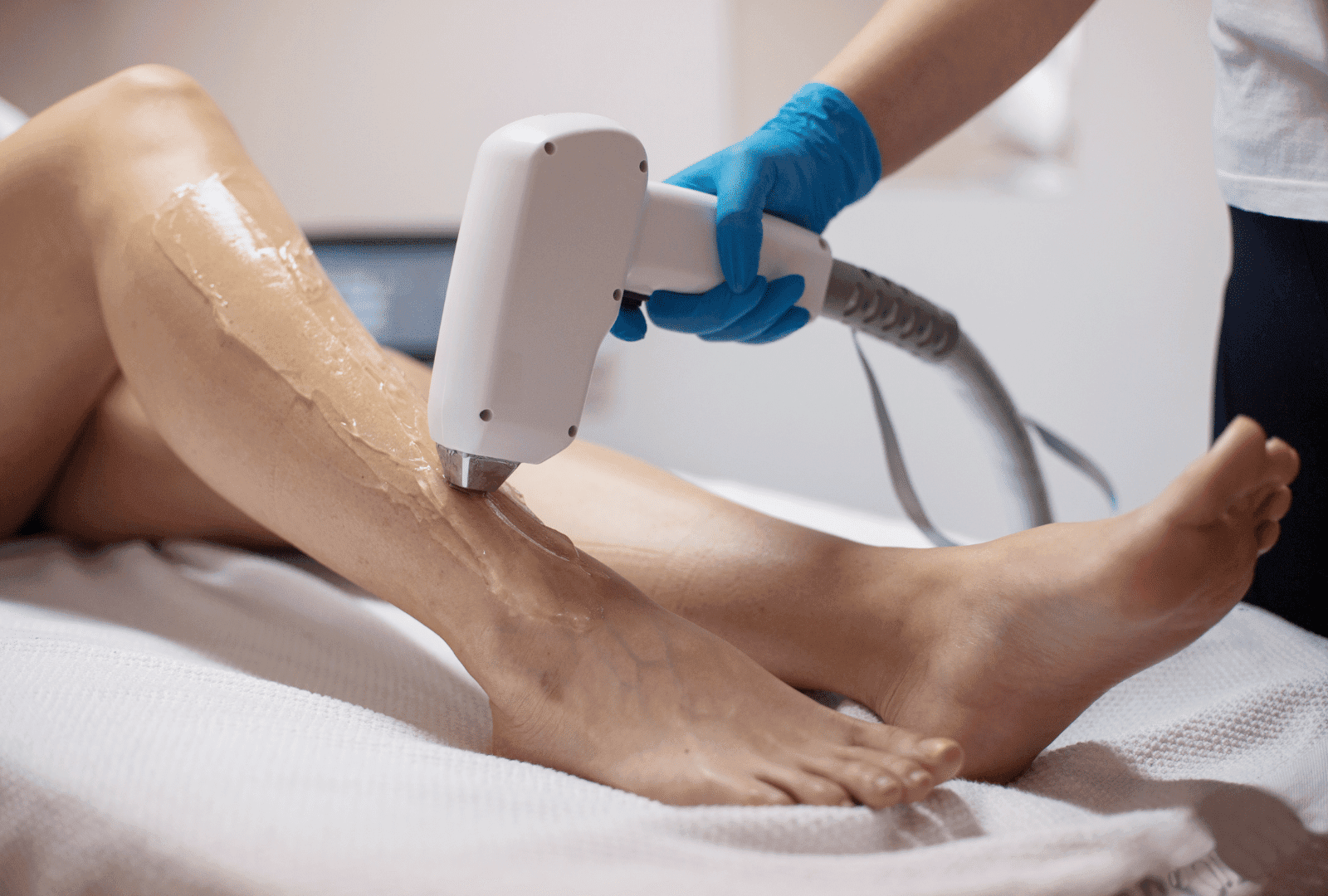 Épilation laser