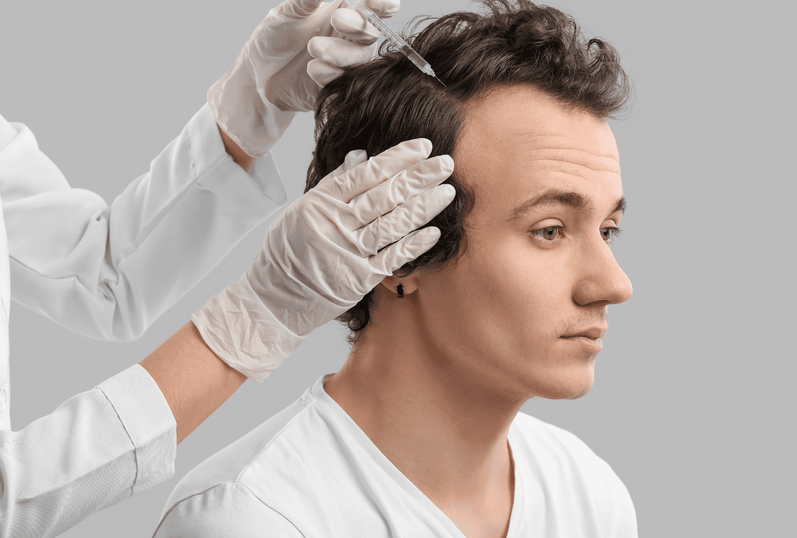 Mésothérapie capillaire sur un homme