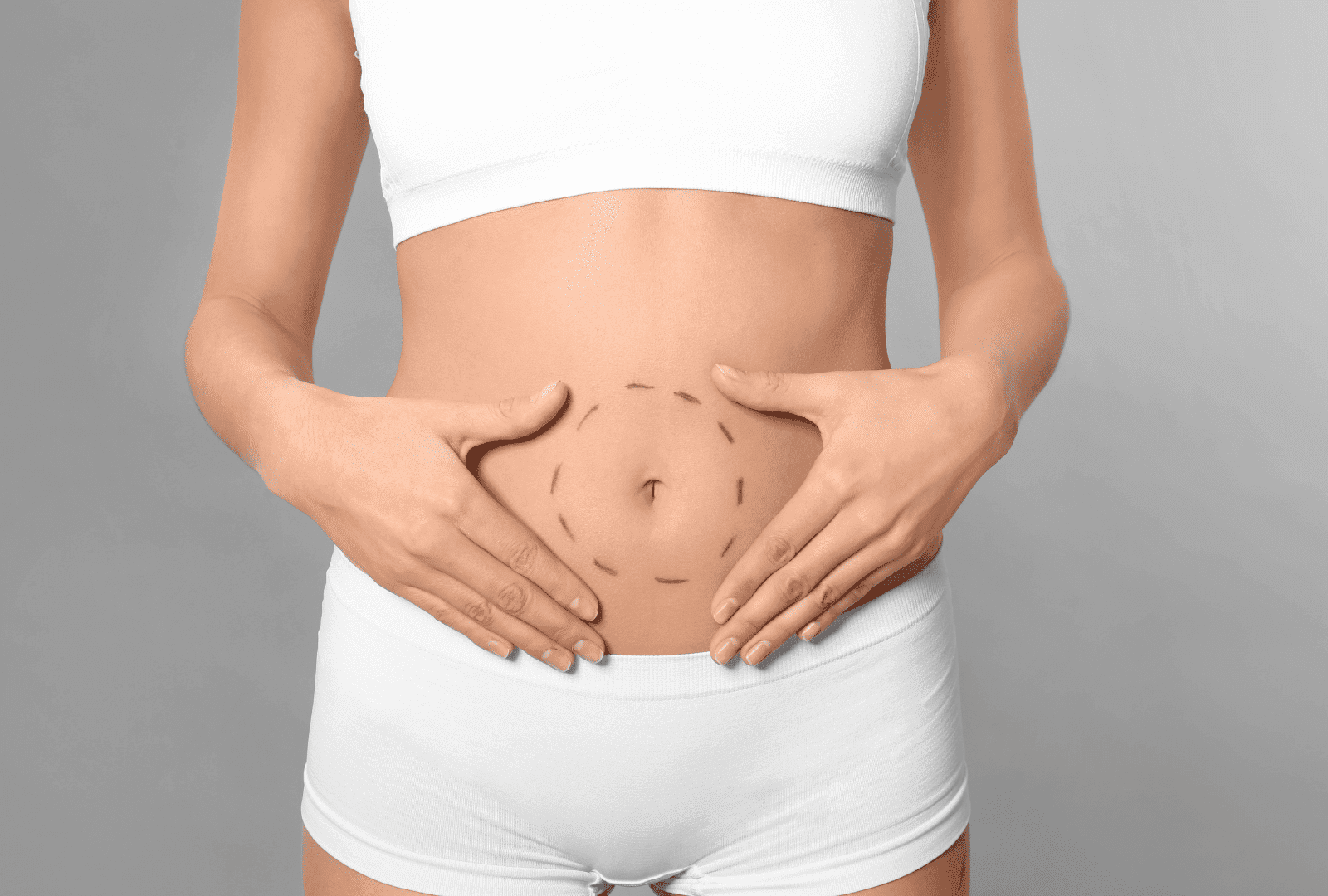 Abdominoplastie