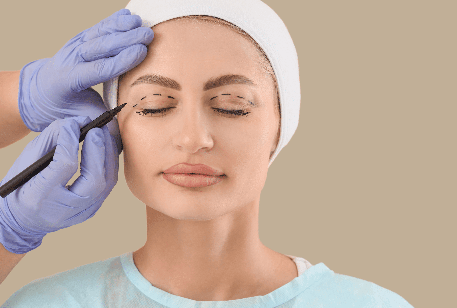 Blépharoplastie