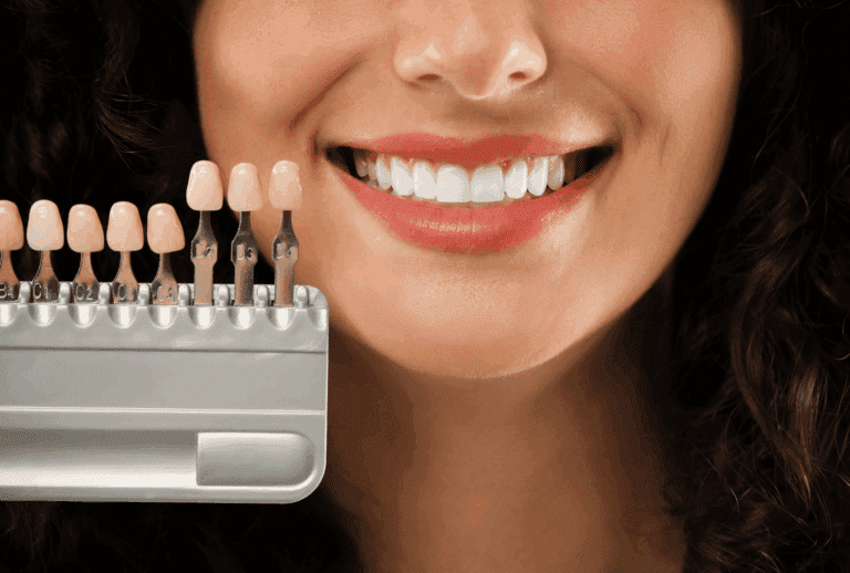 Femme souriante avec des facettes dentaires pour voir les nuances de dents.