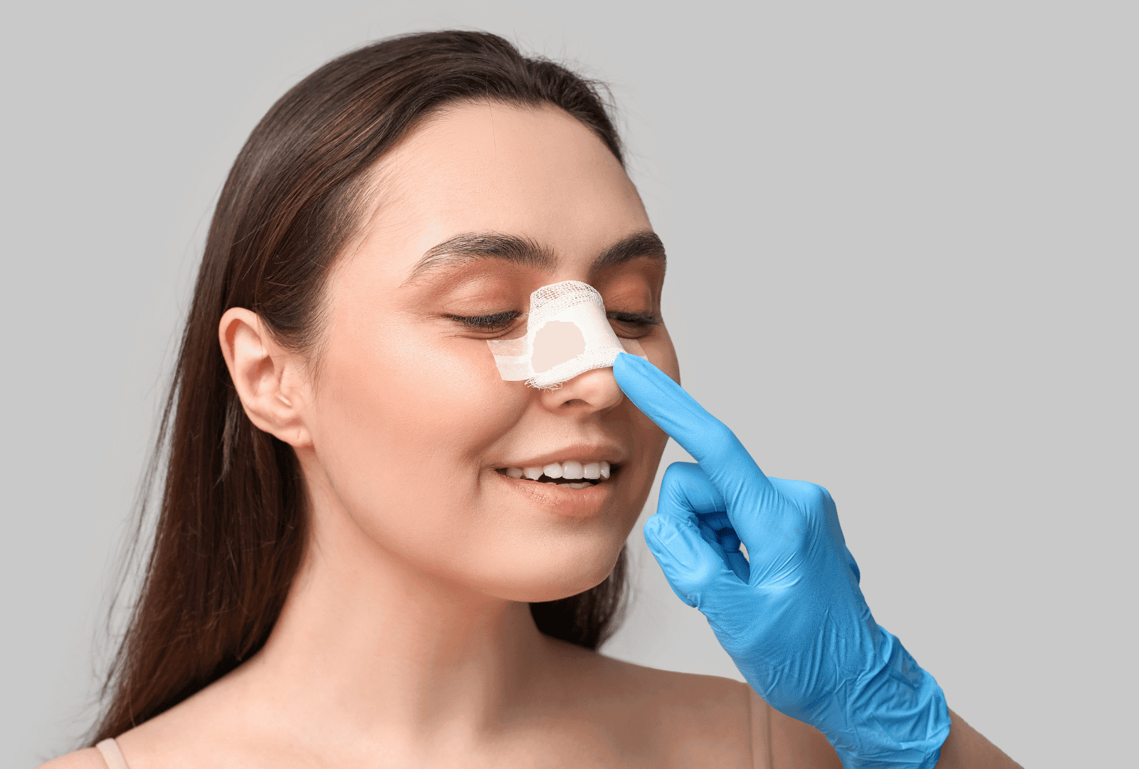 Rhinoplastie