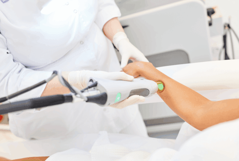 Femme en séance d’épilation définitive au laser Alexandrite