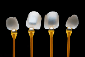 Quatre facettes dentaires illuminés sur fond noir.