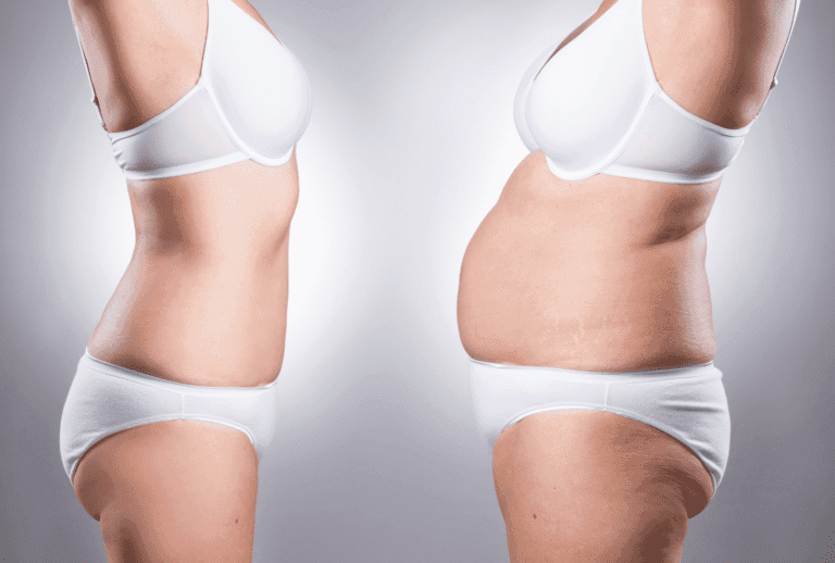 Comparaison de deux silhouettes féminines