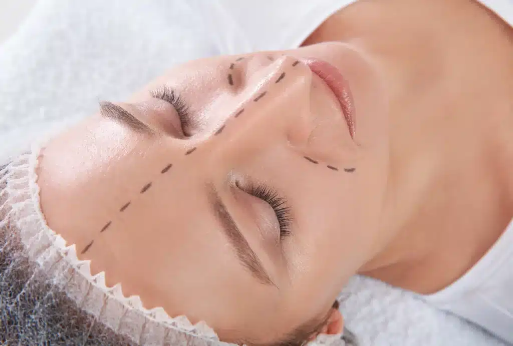 Résultats d’une intervention de chirurgie esthétique du visage