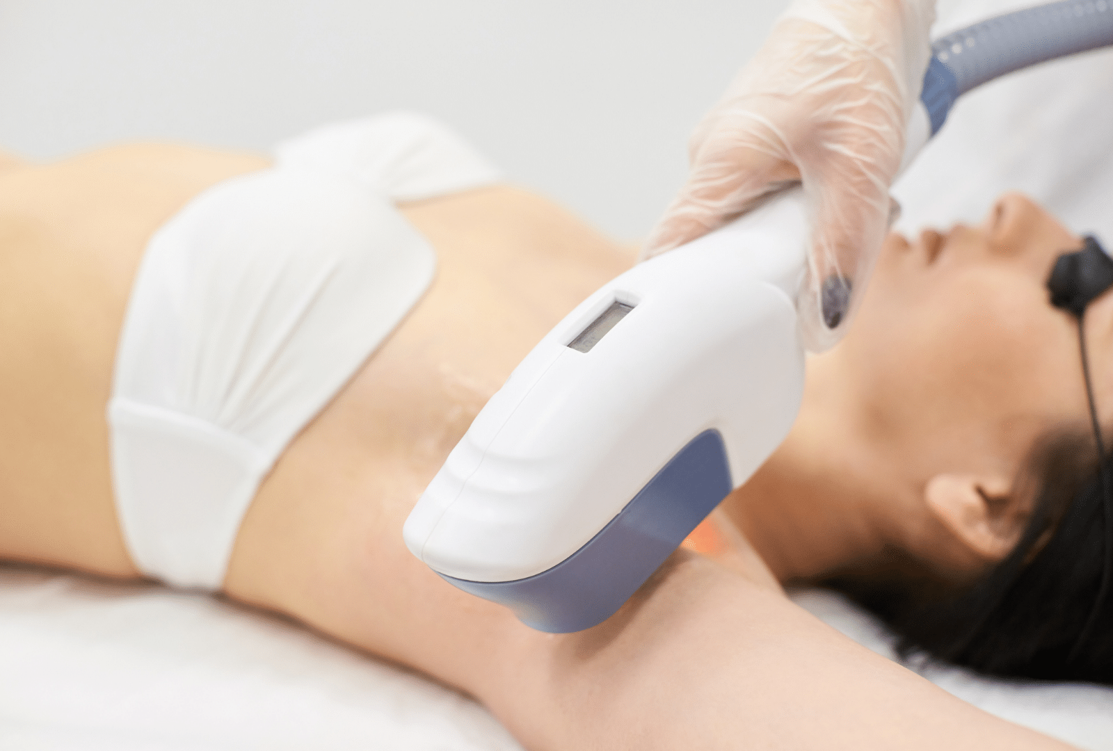 Femme recevant une épilation des aisselles à la lumière pulsée (IPL) dans un centre spécialisé en Suisse.