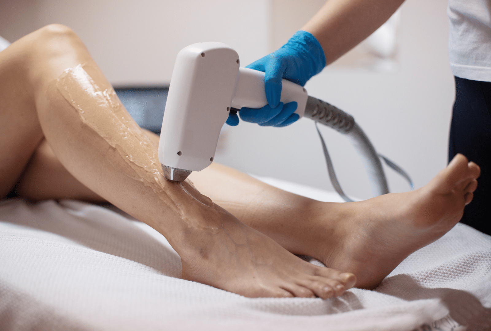 Femme recevant un traitement d’épilation laser médical sur les jambes dans une clinique en Suisse.