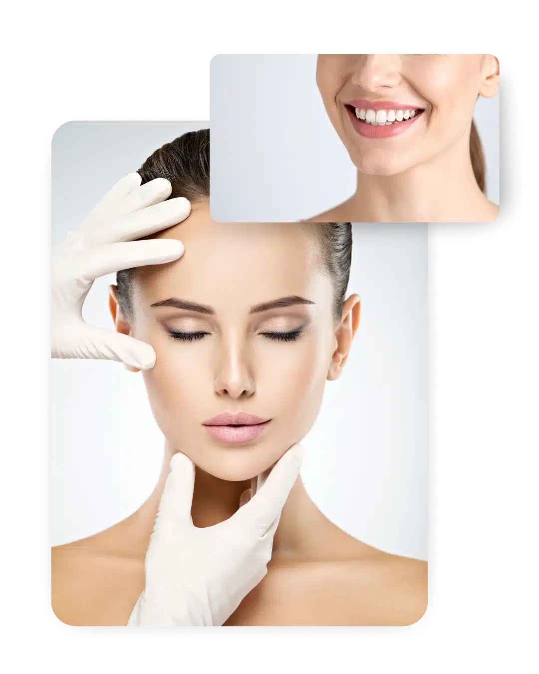 Résultat naturel après un lifting du visage chez une femme