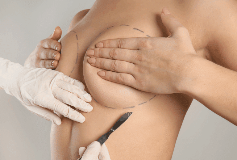 Consultation pour une chirurgie mammaire, anesthésie locale