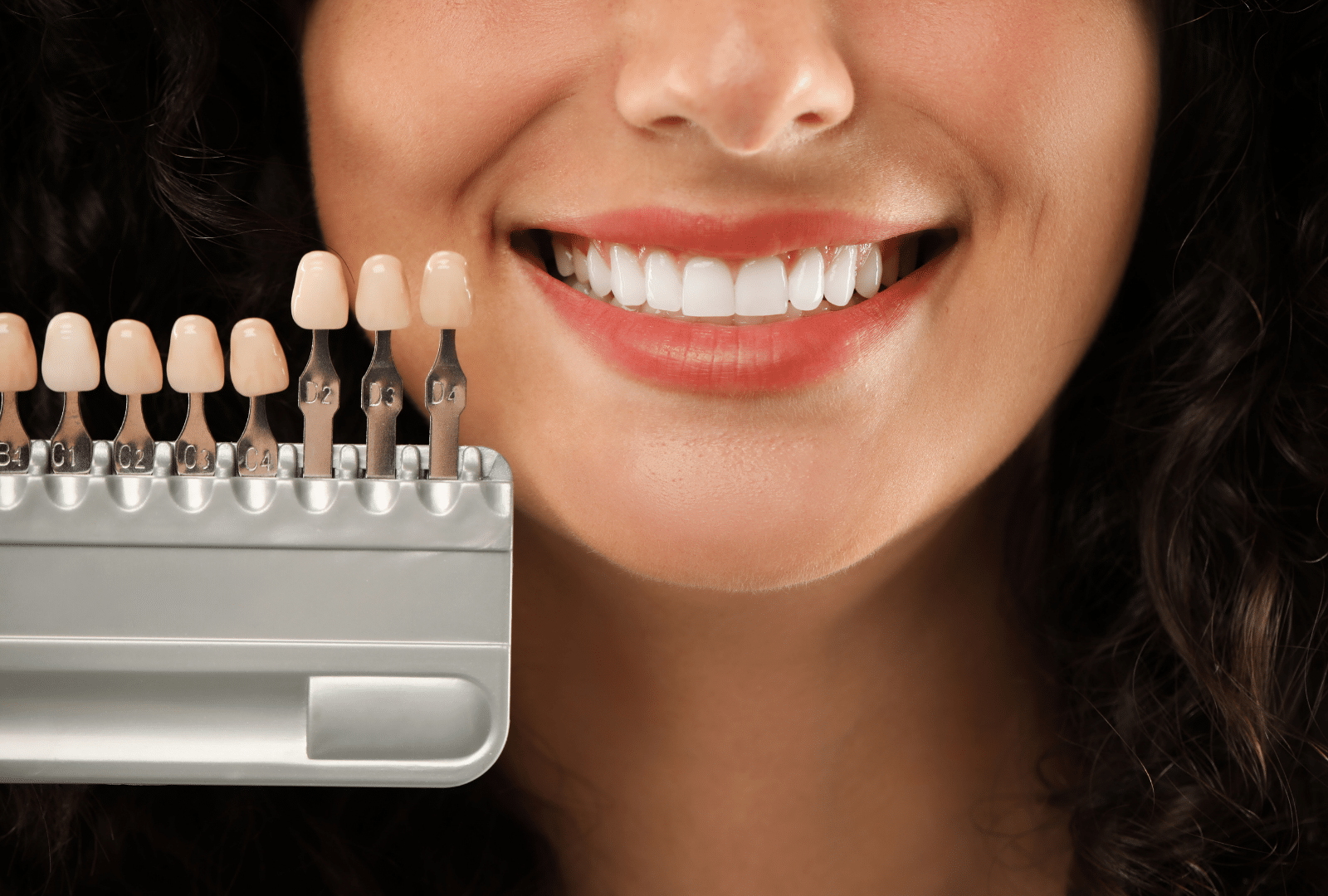 Femme souriante avec des facettes dentaires pour voir les nuances de dents.