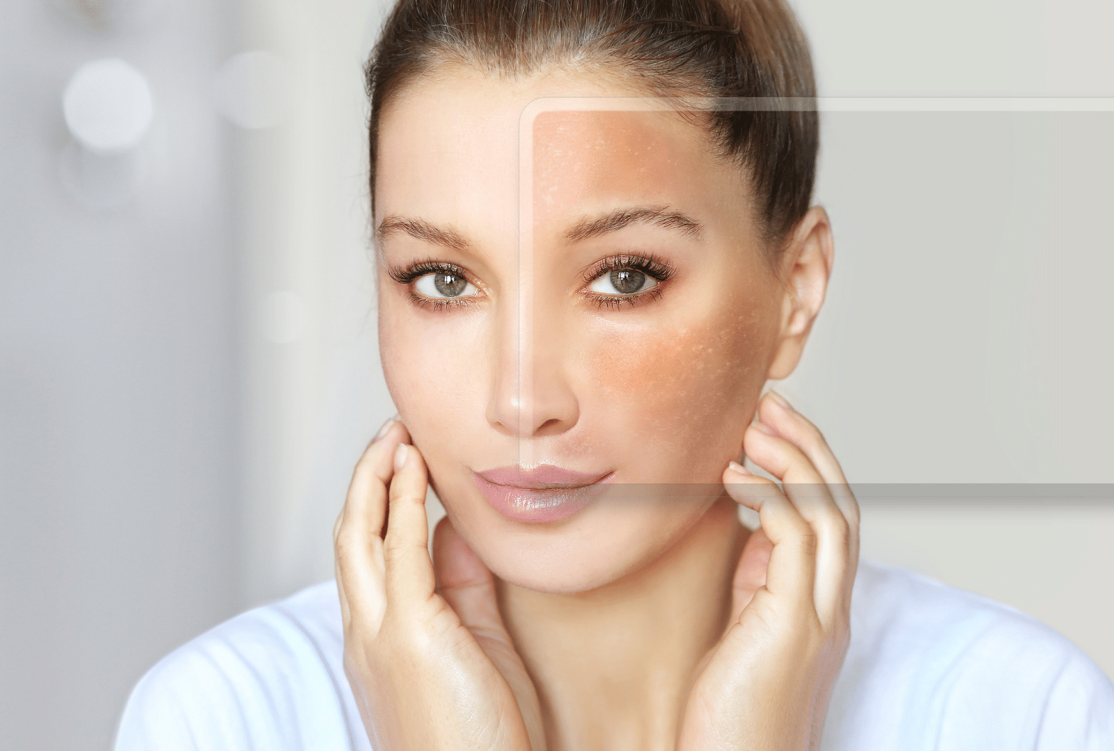 Femme touchant son visage après le traitement des taches pigmentaires