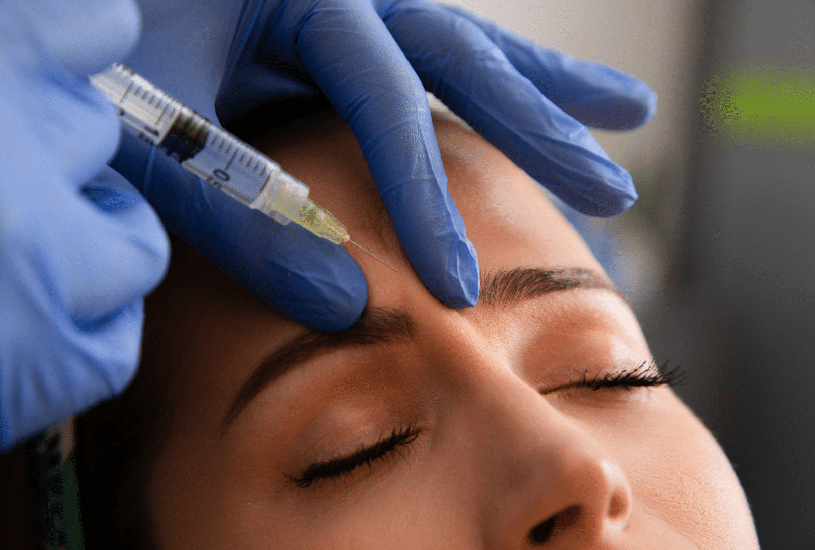 Injection de botox sur le front d'une femme