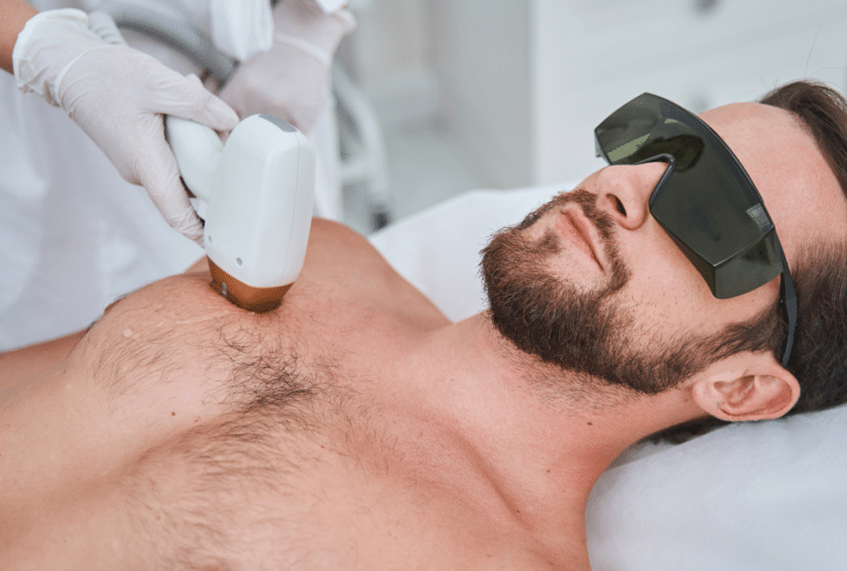 Homme en séance d’épilation laser sur le torse dans un centre médical