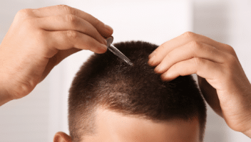 Homme réalisant un soin capillaire sur le cuir chevelu