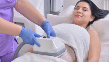Femme allongée recevant un traitement de cryolipolyse sur l’abdomen