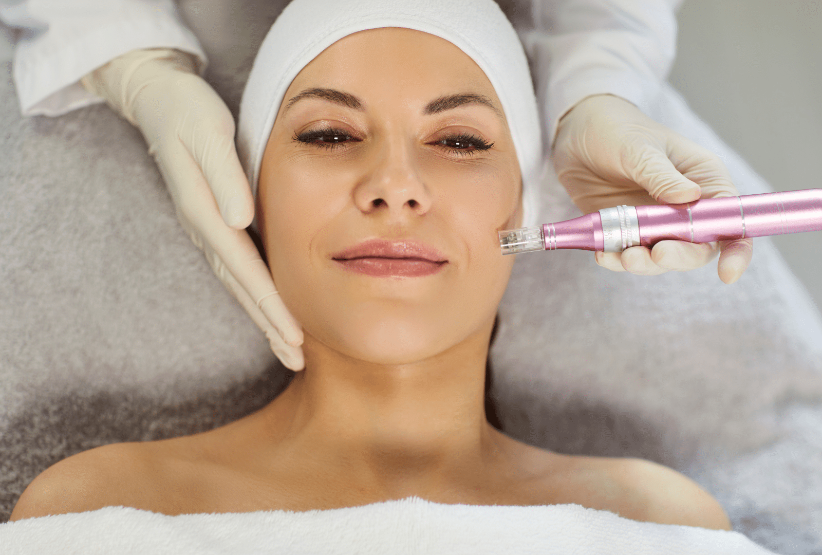 Traitement de la peau avec un dispositif de microneedling.