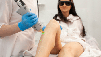 Séance de laser pour épilation des jambes.