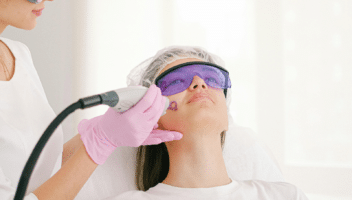 Soins de beauté au laser du visage