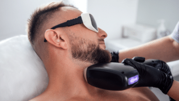 Homme recevant un traitement de peau au laser