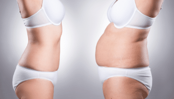 Comparaison de deux silhouettes féminines