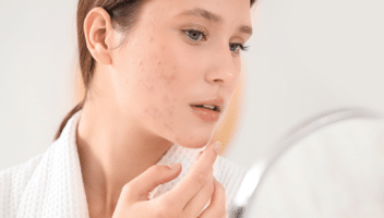 Femme examinant sa peau dans un miroir