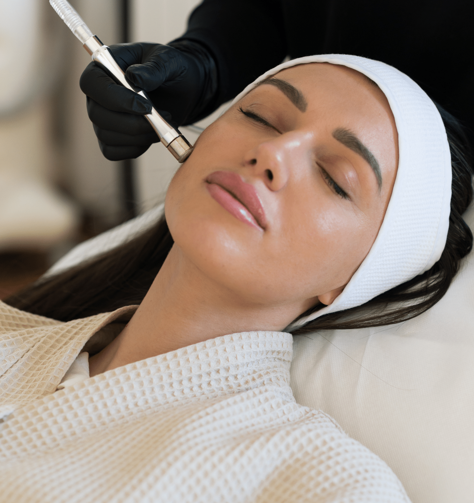 Femme qui reçoit un microdermabrasion du visage