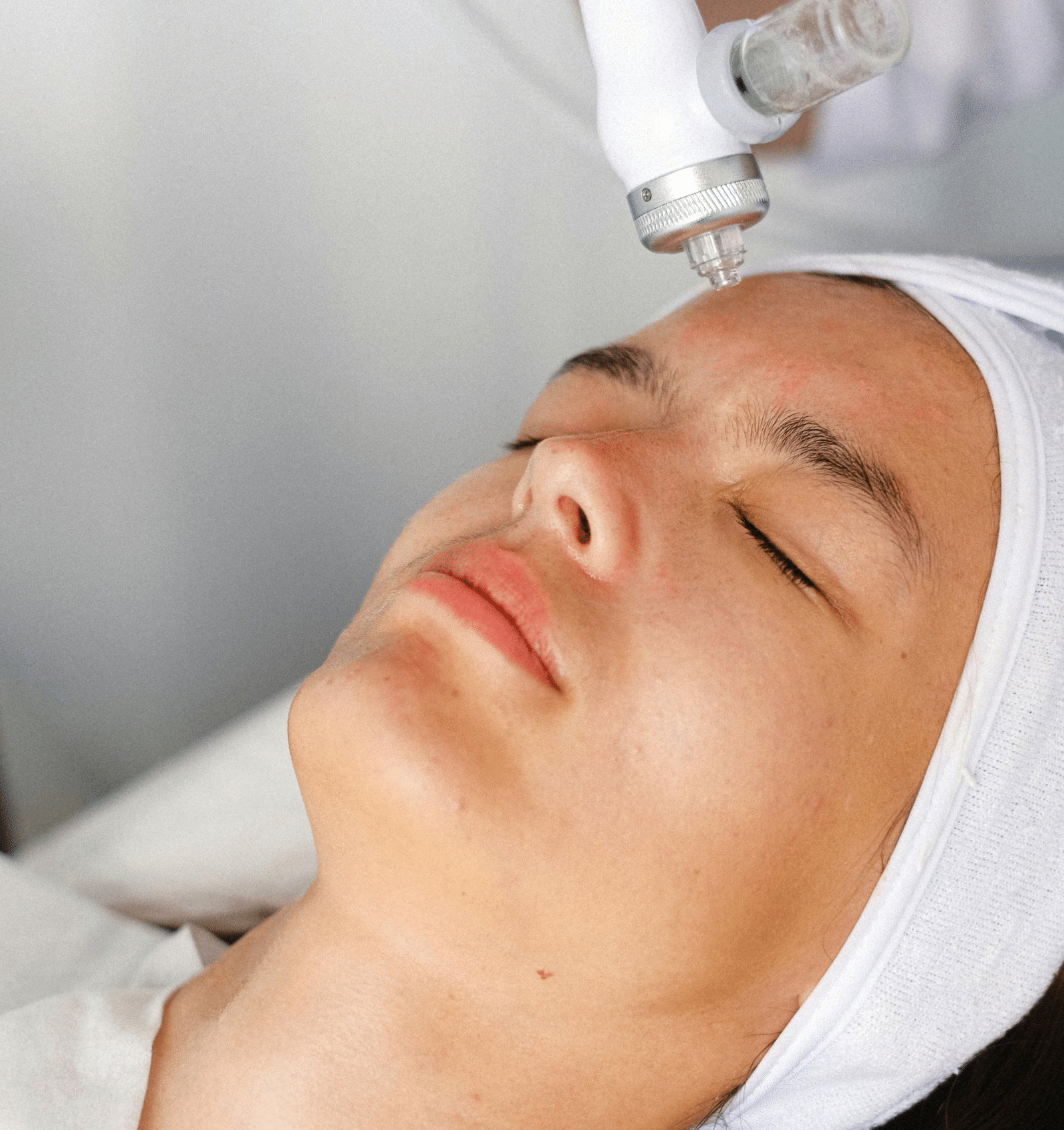 Femme recevant un soin dermatologique esthétique sur le front à l’aide d’un appareil professionnel.