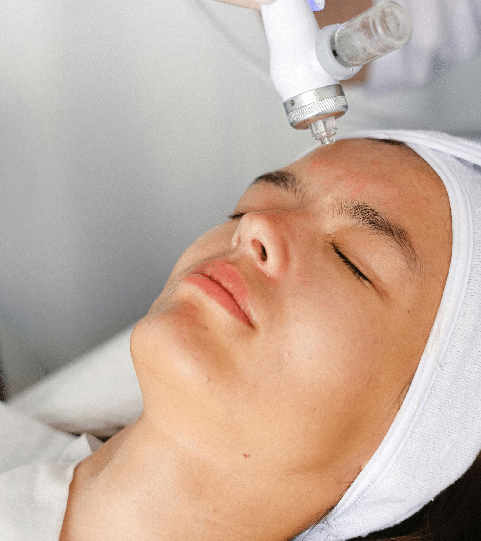 Femme recevant un soin dermatologique esthétique sur le front à l’aide d’un appareil professionnel.