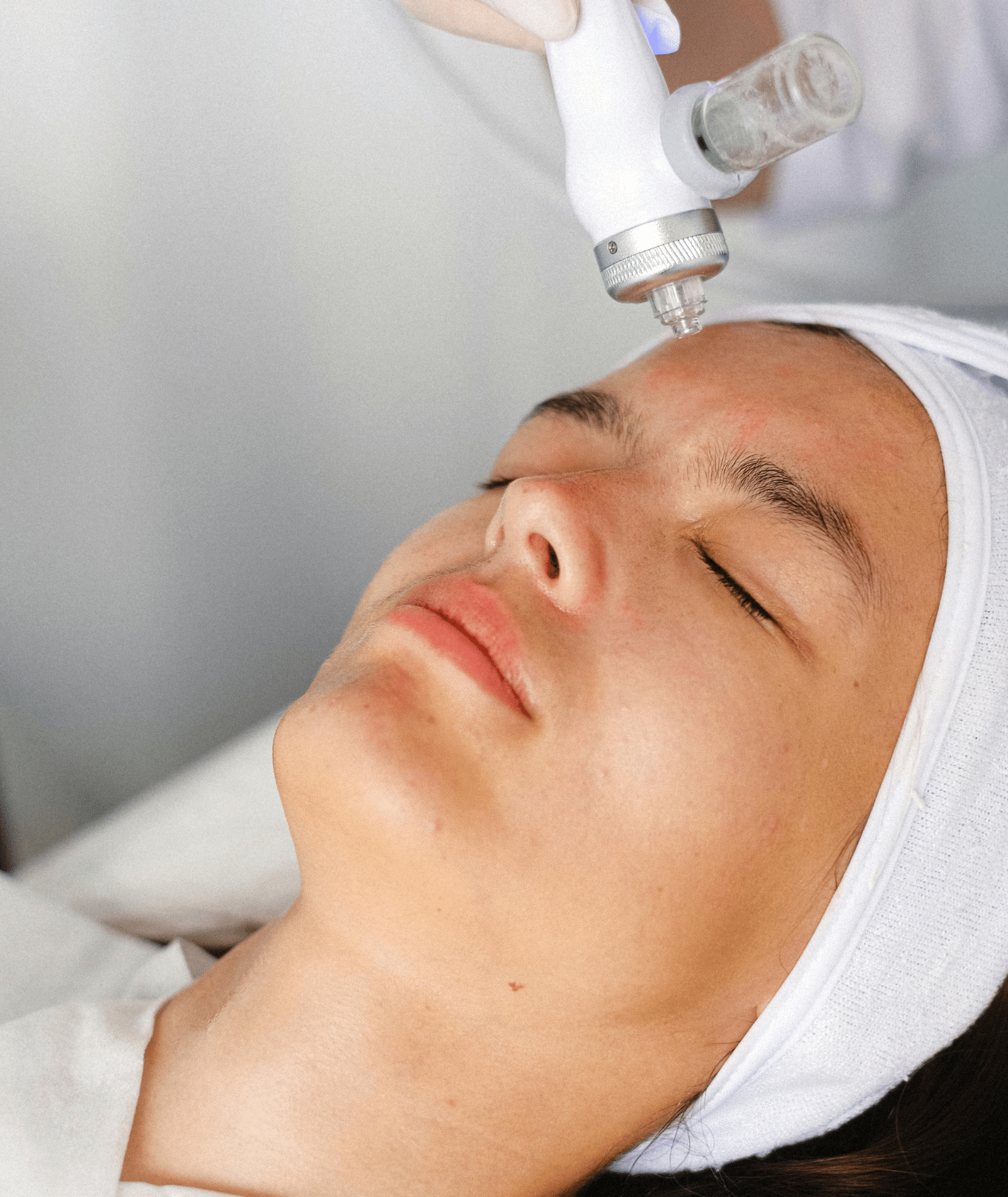 Femme recevant un soin dermatologique esthétique sur le front à l’aide d’un appareil professionnel.