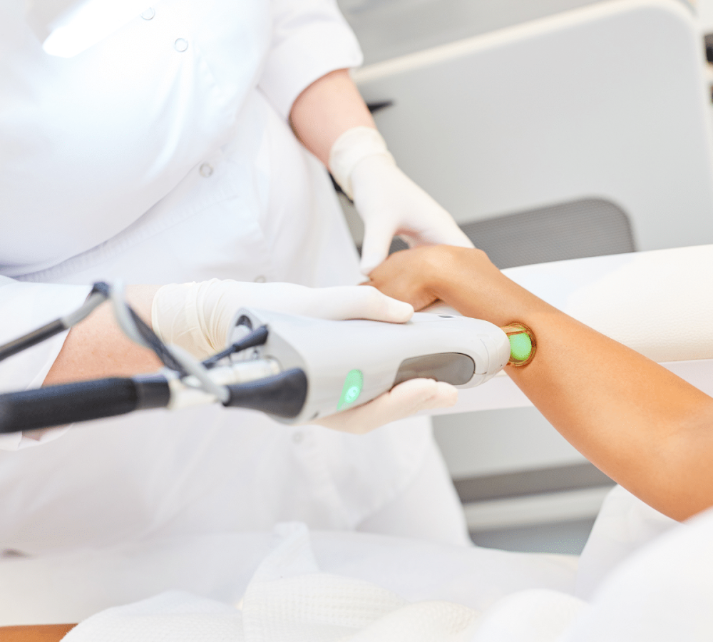 Femme en séance d’épilation définitive au laser Alexandrite